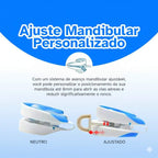 Noite Serena – Protetor Bucal para Ronco e Bruxismo