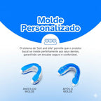 Noite Serena – Protetor Bucal para Ronco e Bruxismo